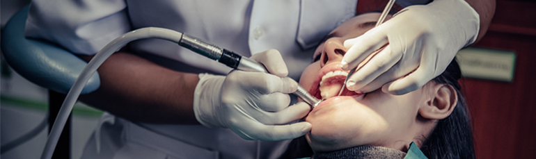 Teeth Cleaning